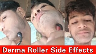 Derma Roller Beard Growth Side effects  Derma Roller [upl. by Nawed]