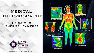 Medical Thermography using FLIR Thermal Camera [upl. by Irianat]