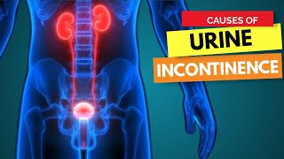 CAUSES OF URINE INCONTINENCE  Dr Betty K [upl. by Aruabea]