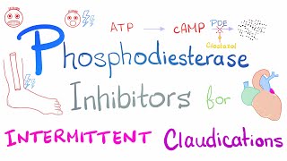 Intermittent Claudications Management [upl. by Lyrred22]