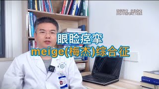 眼睑痉挛 meige梅杰综合征 [upl. by Egroj]