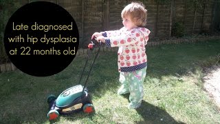 Walking pre operation for hip dysplasia correction DDH diagnosis at age 22 months [upl. by Derayne]