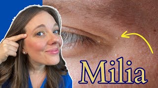 How to Get Rid of Milia  Tiny White Bumps [upl. by Bianka]