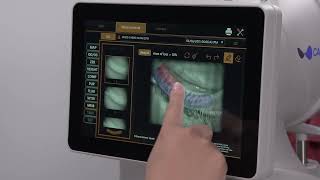 Topcon CA800 Reviewing Meibomian Gland Images [upl. by Ecnahs]