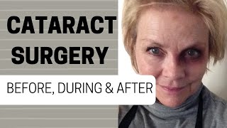 CATARACT SURGERY 1  FROM A PATIENTS PERSPECTIVE [upl. by Breeze775]