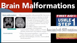 Brain malformations Holoprosencephaly amp Lissencephaly in HindiUrdu by first aid for USMLE step 1 [upl. by Whitcomb51]