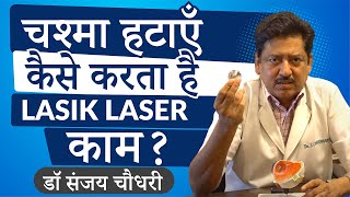 What is Lasik Laser amp what are the options in Lasik Laser eye surgery in Hindi  Eye7 New Delhi [upl. by Seta]