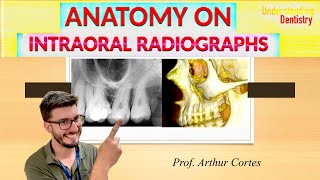 ALL ANATOMICAL LANDMARKS of maxilla and mandible Periapical X Ray and Radiographs Dental Anatomy [upl. by Ynohtnad]