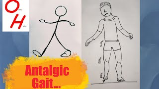 Antalgic gait [upl. by Bedell]