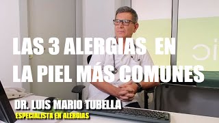 Los 3 tipos de ALERGIAS EN LA PIEL más comunes ⭐ ¿ Se cura la Dermatitis  ⭐ SmartSalus [upl. by Danielle]