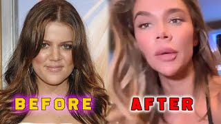 Khloe Kardashian Accidentally Reveals Bad Nose Job She Collapsed [upl. by Radmilla]