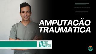 Amputação Traumática na Emergência [upl. by Topping759]