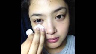 How to avoid swollen eyes in the morning after crying at night [upl. by Armbruster]