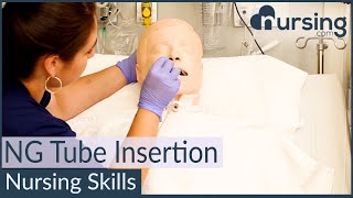 NG Nasogastric Tube Insertion Techniques Nursing Skills [upl. by Tterag]