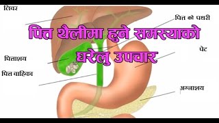 Gall Bladder problem solve at home in Nepali  पित्त थैलीमा हुने समस्याको घरेलु उपचार [upl. by Niwroc]