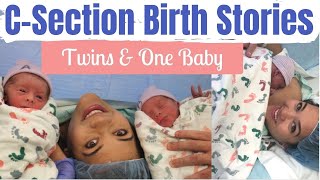 SCHEDULED CSECTION TWINS PREP amp BIRTH STORIES  Planned Cesarean Section  Mai Zimmy [upl. by Brine]