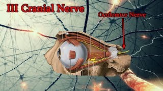 Oculomotor Nerve Palsy III Cranial Nerve palsy Medical animation [upl. by Nesbitt]