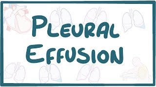 Pleural Effusion  causes symptoms diagnosis treatment pathology [upl. by Kathleen757]