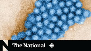 Cases of stomachbug causing norovirus on the rise in Canada [upl. by Atok]