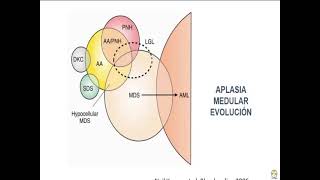 Radiología en 5 minutos Aplasia coclear [upl. by Siugram]