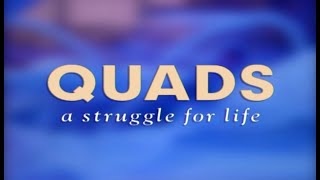 Aversa Quads Identical Quadruplets  Quads A Struggle For Life 1998 Documentary [upl. by Anilahs]