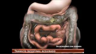 sindrome de intestino irritable [upl. by Assereht560]