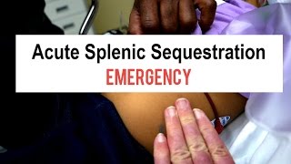 Sickle Cell Splenic Sequestration Emergency [upl. by Nivrek]