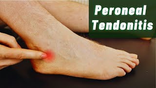 Peroneal Tendonitis Explained by Foot Specialists [upl. by Stanway890]