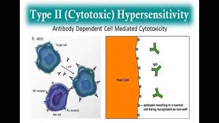 10 Hypersensitivity reactions Type 2  3 and 4 Hypersensitivity reactions شرح بالعربي [upl. by Solotsopa998]