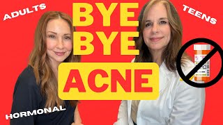 BYE BYE ACNE Adult Hormonal even Teens [upl. by Nemrac]