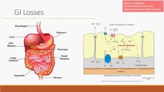 NonAnion Gap Metabolic Acidosis  GIGU Losses See updated video [upl. by Finnigan]