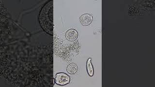 Paramecium and Ciliates 100x  800x Magnification science microscope 14 [upl. by Daitzman]