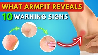 What Your Armpit Tells About Your Health 10 Warning Signs  Lump  Lymph Nodes  Armpit Pain [upl. by Nytsirhc728]