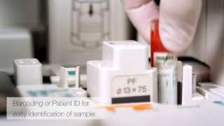 FUJIFILM NX 500  Laboratory diagnosis in minutes  more time for your patients [upl. by Isle538]