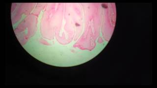 Squamous cell papilloma histopathology [upl. by Llemhar]