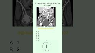 Abdomen Buzz 7 radiologychannel007 [upl. by Editha]