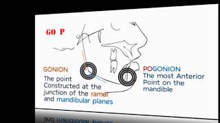 Cephalometrics Part II [upl. by Clarey]