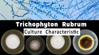 Trichophyton Rubrum culture Characteristic [upl. by Laeira]