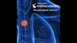 Clinical Scenarios and Approaches to Treating Locally Advanced Esophageal Adenocarcinoma [upl. by Lonne520]