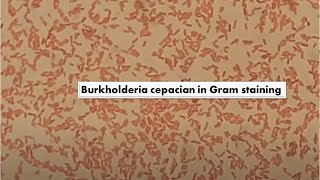 Burkholderia cepacia in Gram Staining of Culture Mag4000X [upl. by Fernald]