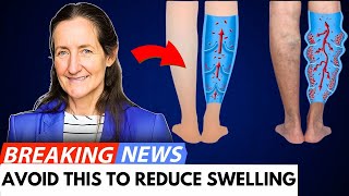 Barbara ONeills Natural Remedies For Swollen Legs and Feet That Works INSTANTLY [upl. by Ayahs]