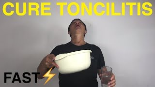 How to cure tonsillitis naturally [upl. by Aylmer452]