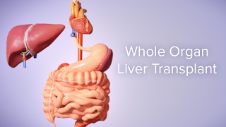 Liver Transplant  Cincinnati Childrens [upl. by Resaec816]