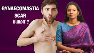 Gynaecomastia Scar பயமா   DrCharumathy Explains [upl. by Kucik]