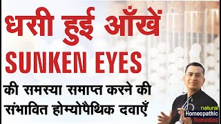 धंसी हुई आँखें  Sunken Eyes  Natural homeopathic remedies with symptoms [upl. by Nonac648]