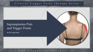 Supraspinatus Pain and Trigger Points [upl. by Old]