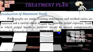 Diagnosis and treatment planing in fixed prosthdontics part two [upl. by Eldwen]