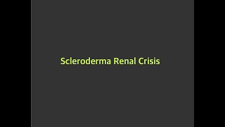 Scleroderma Renal crisis [upl. by Adelia]