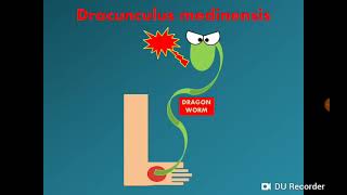 Dracunculus medinensis Dracontiasis الدودة التنين [upl. by Landers]