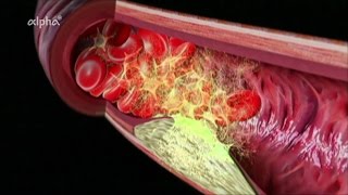 HerzKreislaufErkrankungen  Blutkreislauf  alpha Lernen erklärt Biologie [upl. by Janenna215]